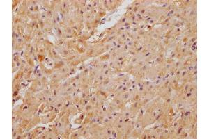 IHC image of ABIN7175041 diluted at 1:100 and staining in paraffin-embedded human heart tissue performed on a Leica BondTM system. (C22ORF39 anticorps  (AA 1-142))