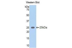 Western Blotting (WB) image for anti-Keratin 5 (KRT5) (AA 335-473) antibody (ABIN1172972) (Cytokeratin 5 anticorps  (AA 335-473))