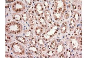 Image no. 10 for anti-Myc Proto-Oncogene protein (MYC) antibody (ABIN1497013) (c-MYC anticorps)