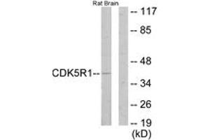 Western blot analysis of extracts from rat brain cells, using CDK5R1 Antibody. (CDK5R1 anticorps  (AA 11-60))