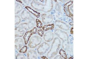 Immunohistochemistry of paraffin-embedded mouse kidney using MTCO2 Rabbit pAb (ABIN7266639) at dilution of 1:500 (40x lens). (COX2 anticorps  (AA 100-200))