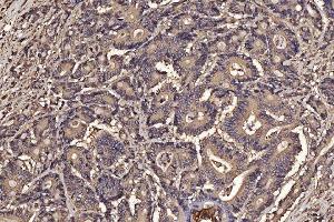 IHC analysis of PDIA6 using anti-PDIA6 antibody (ABIN7600554). (PDIA6 anticorps  (AA 20-440))