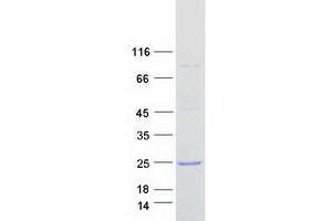 Validation with Western Blot