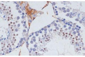 Immunohistochemistry of paraffin-embedded Mouse testis using SKIV2L2 Polyclonal Antibody at dilution of 1:100 (40x lens). (MTR4 anticorps)
