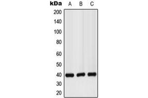 Western blot analysis of GPR160 expression in LO2 (A), mouse liver (B), rat kidney (C) whole cell lysates. (GPR160 anticorps  (C-Term))