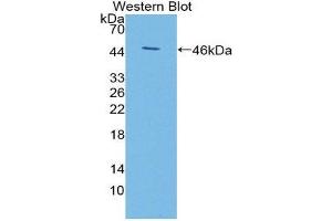Western Blotting (WB) image for anti-KiSS-1 Metastasis-Suppressor (KISS1) (AA 1-126) antibody (ABIN1868842) (KISS1 anticorps  (AA 1-126))