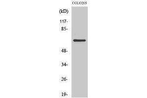 Western Blotting (WB) image for anti-Coenzyme Q8A (COQ8A) (Internal Region) antibody (ABIN3179898) (COQ8A anticorps  (Internal Region))