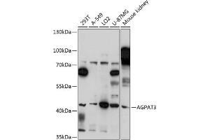 Western blot analysis of extracts of various cell lines, using  antibody (ABIN7265305) at 1:3000 dilution. (AGPAT3 anticorps  (AA 145-310))