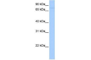 SAMD4A antibody used at 1 ug/ml to detect target protein. (SAMD4A anticorps  (Middle Region))