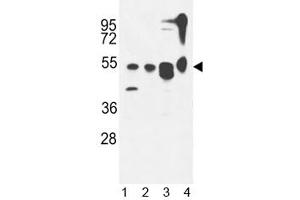 ATG13 antibody western blot analysis in 1) MDA-MB435,2) CEM, 3) T47D cell line and 4) mouse cerebellum tissue lysate.