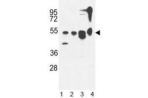 ATG13 antibody western blot analysis in 1) MDA-MB435,2) CEM, 3) T47D cell line and 4) mouse cerebellum tissue lysate. (ATG13 anticorps  (AA 1-30))