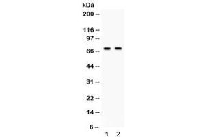 Western blot testing of human 1) 22RV1 and 2) 293 cell lysate with FZD1 antibody.