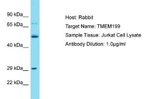 Host: Rabbit Target Name: TMEM199 Sample Tissue: Human Jurkat Whole Cell Antibody Dilution: 1ug/ml (TMEM199 anticorps  (N-Term))