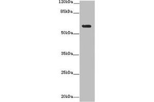 Western blot All lanes: EHD1 antibody at 12 μg/mL + MDA-MB-231 whole cell lysate Secondary Goat polyclonal to rabbit IgG at 1/10000 dilution Predicted band size: 61 kDa Observed band size: 61 kDa (EHD1 anticorps  (AA 401-498))