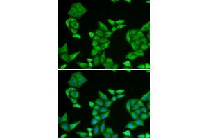 Immunofluorescence analysis of U2OS cells using COX5A antibody.