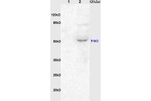 L1 rat kidney lysates, L2 rat brain lysates probed (ABIN738396) Anti-ChRM1/Acetylcholine receptor(M1) Polyclonal, Unconjugated at 1:200 in 4 °C.