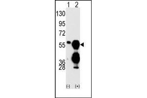 Image no. 1 for anti-Protein Phosphatase 1F (PP2C Domain Containing) (PPM1F) (C-Term) antibody (ABIN360801) (PPM1F anticorps  (C-Term))
