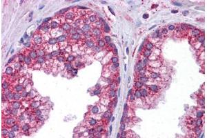 Human Prostate: Formalin-Fixed, Paraffin-Embedded (FFPE)