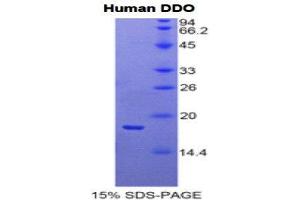 SDS-PAGE (SDS) image for D-Aspartate Oxidase (DDO) (AA 170-304) protein (His tag) (ABIN1170291)