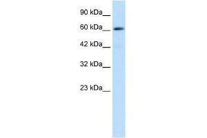 Western Blot showing ZNF499 antibody used at a concentration of 1-2 ug/ml to detect its target protein. (ZBTB45 anticorps  (Middle Region))