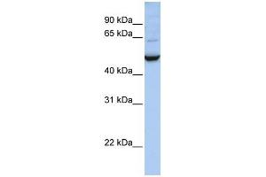 IDH1 antibody used at 1 ug/ml to detect target protein. (IDH1 anticorps)