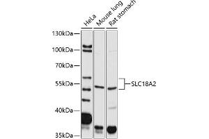 Western blot analysis of extracts of various cell lines, using SLC18 antibody (799) at 1:2000 dilution. (SLC18A2 anticorps)