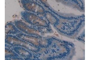 Detection of TFF3 in Rat Intestine Tissue using Polyclonal Antibody to Trefoil Factor 3 (TFF3) (TFF3 anticorps  (AA 23-81))
