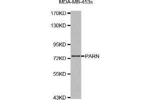Western blot analysis of extracts of MDA-MB-453s cell lines, using PARN antibody. (PARN anticorps  (AA 1-280))