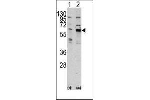 Image no. 1 for anti-PAK3 (PAK3) (Middle Region) antibody (ABIN360320)