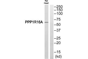Western blot analysis of extracts from Rat heart cells, using PPP1R16A antibody. (PPP1R16A anticorps  (Internal Region))