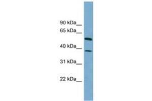 Image no. 1 for anti-Hepatic and Glial Cell Adhesion Molecule (HEPACAM) (AA 107-156) antibody (ABIN6743842) (HEPACAM anticorps  (AA 107-156))