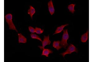 ABIN6259882 and ABIN6273091 staining HepG2 by IF/ICC.