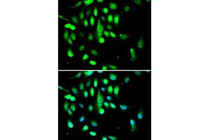 Immunofluorescence analysis of A549 cells using CDK1 antibody. (CDK1 anticorps)