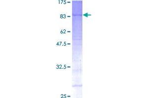 Image no. 1 for Multiple Endocrine Neoplasia 1 (MEN1) (AA 1-575) protein (GST tag) (ABIN1310714)