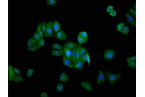 Immunofluorescence staining of HepG2 cells with ABIN7153297 at 1:166, counter-stained with DAPI. (GRK5 anticorps  (AA 406-590))
