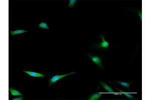 Immunofluorescence of purified MaxPab antibody to ENOPH1 on HeLa cell.