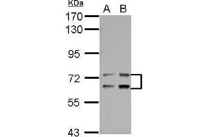 WB Image Sample (30 ug of whole cell lysate) A: Jurkat B: Raji 7. (LTA4H anticorps)