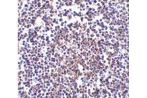 Immunohistochemistry of Aven in human spleen tissue with Aven antibody at 5 μg/ml.