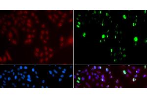 Immunofluorescence analysis of GFP-RNF168 transgenic U2OS cells using FANCD2 Polyclonal Antibody