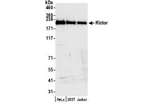 Western Blotting (WB) image for anti-RPTOR Independent Companion of mTOR, Complex 2 (RICTOR) (C-Term) antibody (ABIN7454633) (RICTOR anticorps  (C-Term))