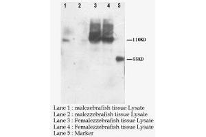 Image no. 1 for anti-Patatin-Like phospholipase Domain Containing 6 (PNPLA6) (C-Term) antibody (ABIN1493338) (PNPLA6 anticorps  (C-Term))