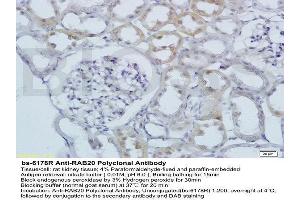 Formalin-fixed and paraffin embedded rat kidney labeled with Anti RAB20 Polyclonal Antibody, Unconjugated  at 1:200 followed by conjugation to the secondary antibody and DAB staining (RAB20 anticorps  (AA 131-234))