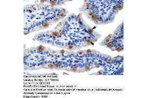 Human Lung (MCM6 anticorps  (C-Term))