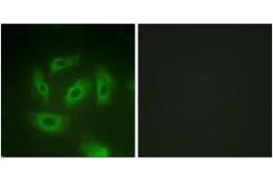 Immunofluorescence (IF) image for anti-Transforming Growth Factor, beta Receptor 1 (TGFBR1) (AA 131-180) antibody (ABIN2888904)