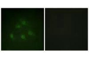 Immunofluorescence analysis of HeLa cells, using Smad1 (Ab-187) antibody.