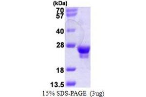 SDS-PAGE (SDS) image for RAB18, Member RAS Oncogene Family (RAB18) (AA 1-206) protein (T7 tag) (ABIN667980)