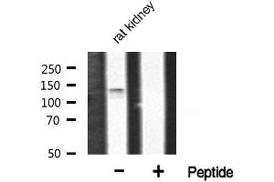 Western blot analysis of FGFR1 phosphorylation expression in rat kidney tissue lysates,The lane on the right is treated with the antigen-specific peptide. (FGFR1 anticorps  (pTyr766))