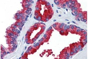 Human Prostate: Formalin-Fixed, Paraffin-Embedded (FFPE)