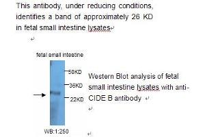 Image no. 1 for anti-Cell Death-Inducing DFFA-Like Effector B (CIDEB) antibody (ABIN790841) (CIDEB anticorps)