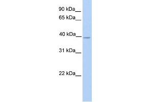 WB Suggested Anti-NEK6 Antibody Titration:  0. (NEK6 anticorps  (N-Term))